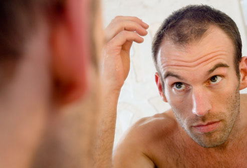 regrow frontal hair loss